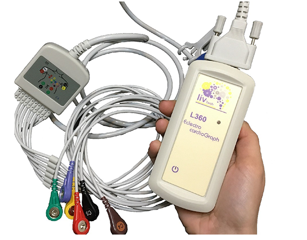 ECG